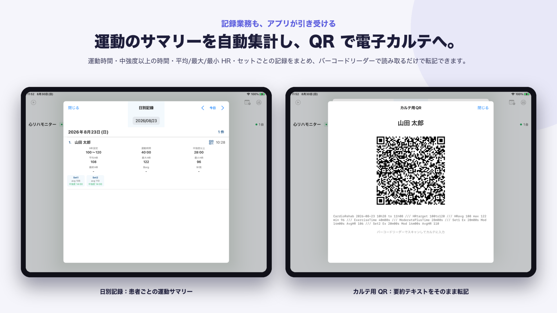 日別記録とカルテ用 QR の画面